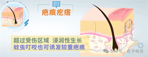 图片细节说明